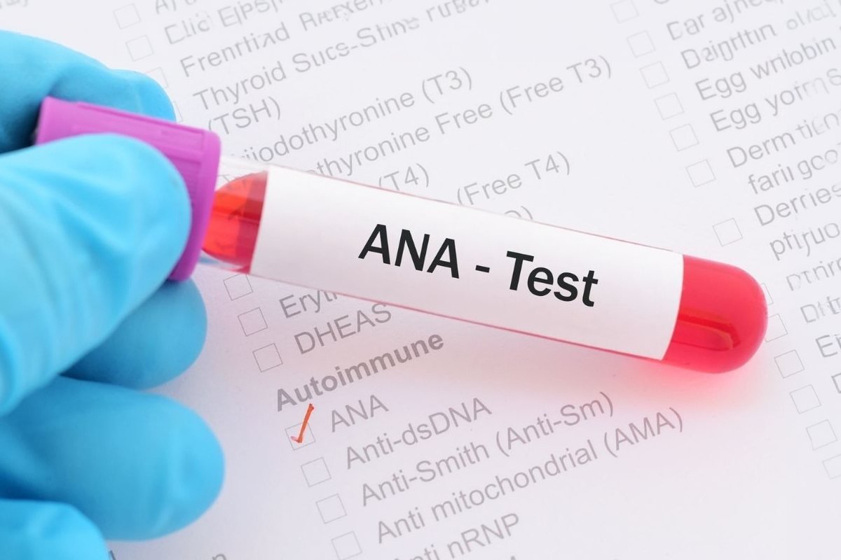 Skills in Immunology Test — ANA
