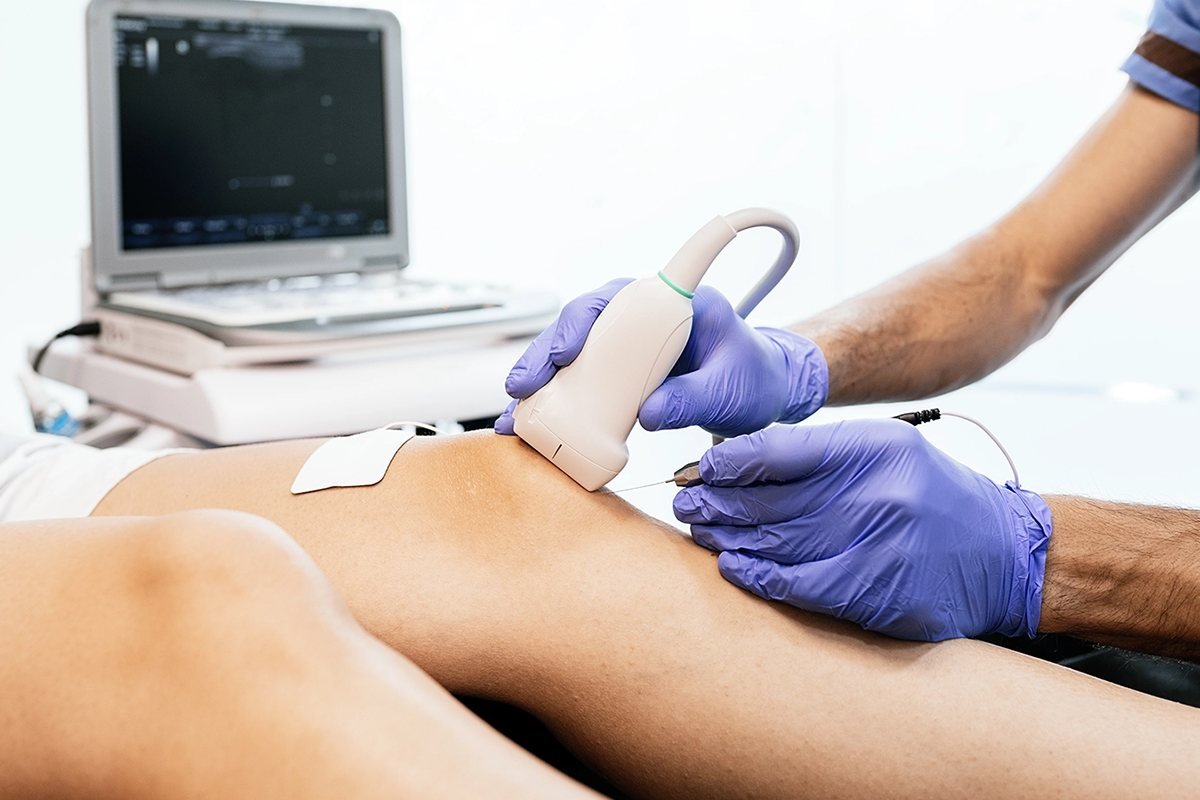 Musculoskeletal (MSK) Ultrasound Procedures