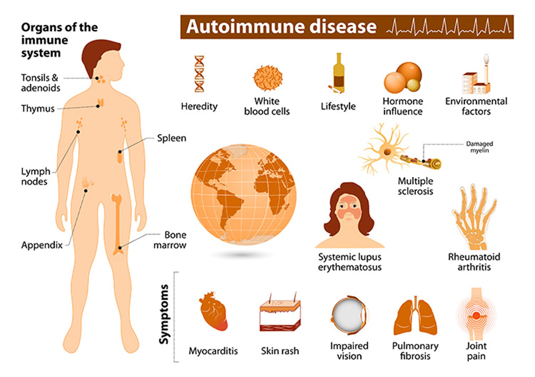 Autoimmune Rheumatic Disease